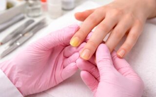 Unhas amareladas e micose de unha: cuidados essenciais para manicures