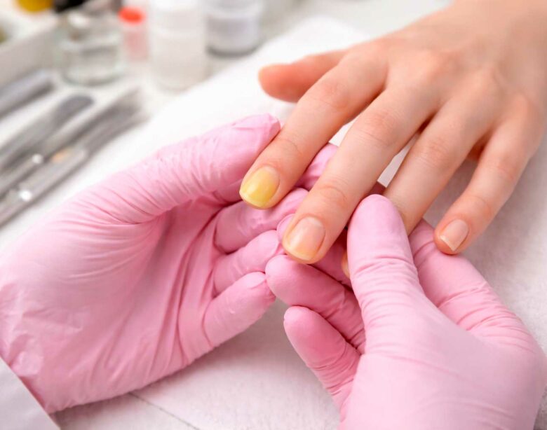 Unhas amareladas e micose de unha: cuidados essenciais para manicures