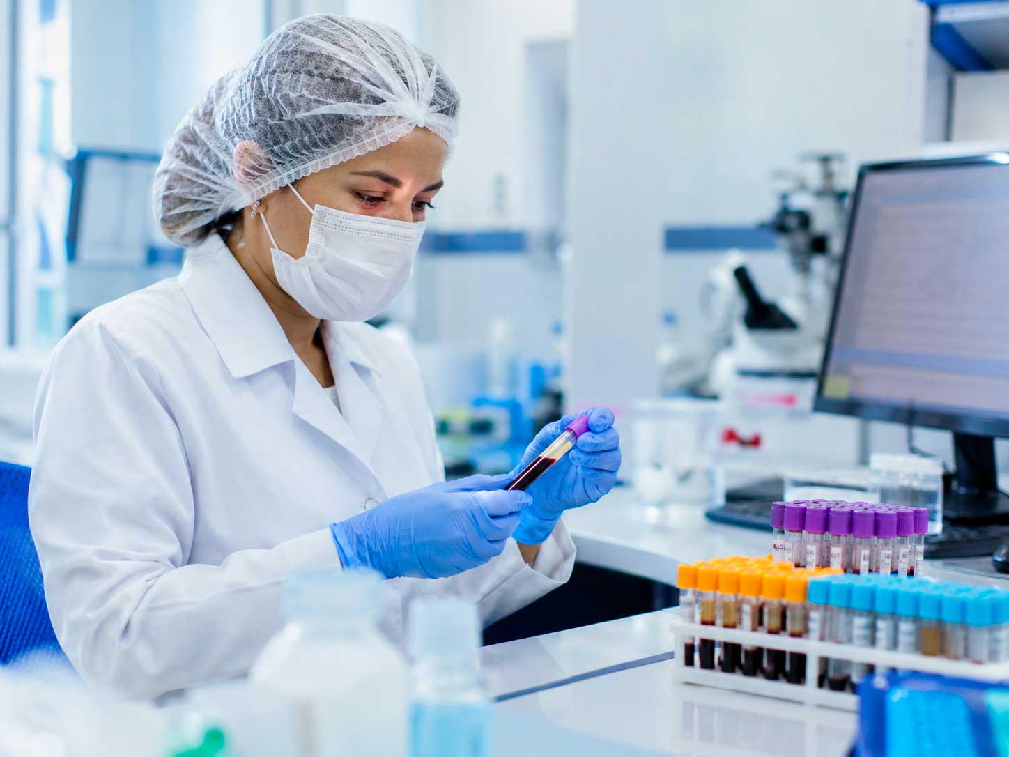 Exames laboratoriais utilizados na investigação de deficiência de ferro e anemia