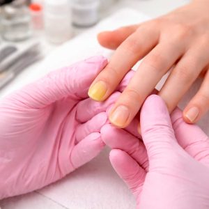 Unhas amareladas e micose de unha: cuidados essenciais para manicures